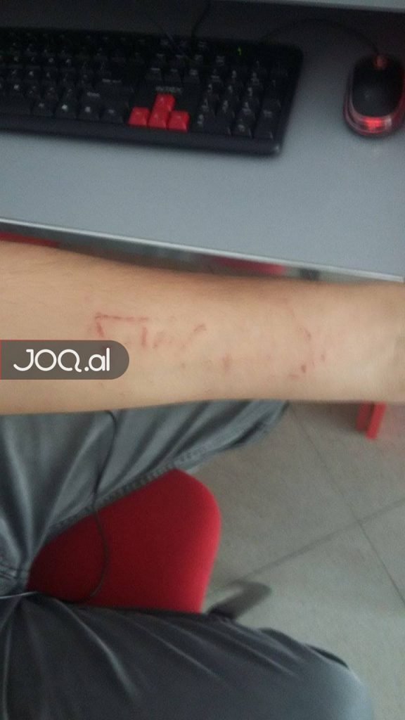 “BALENA BLU”/ 28 vjeçari bie pre e lojës, rrëfehen kolegët: E kapëm me dorë të prerë