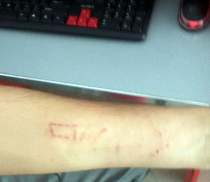 DENONCIMI/ “Balena Blu” fut në kurth edhe një 14 vjeçare në Fier