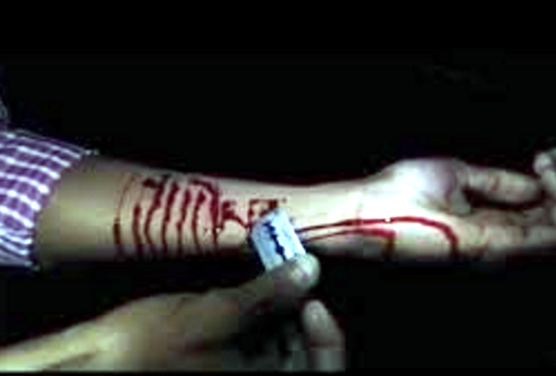 Durrës, 24 vjeçarja pret damarët, babai denoncon dy misionaret e kishës