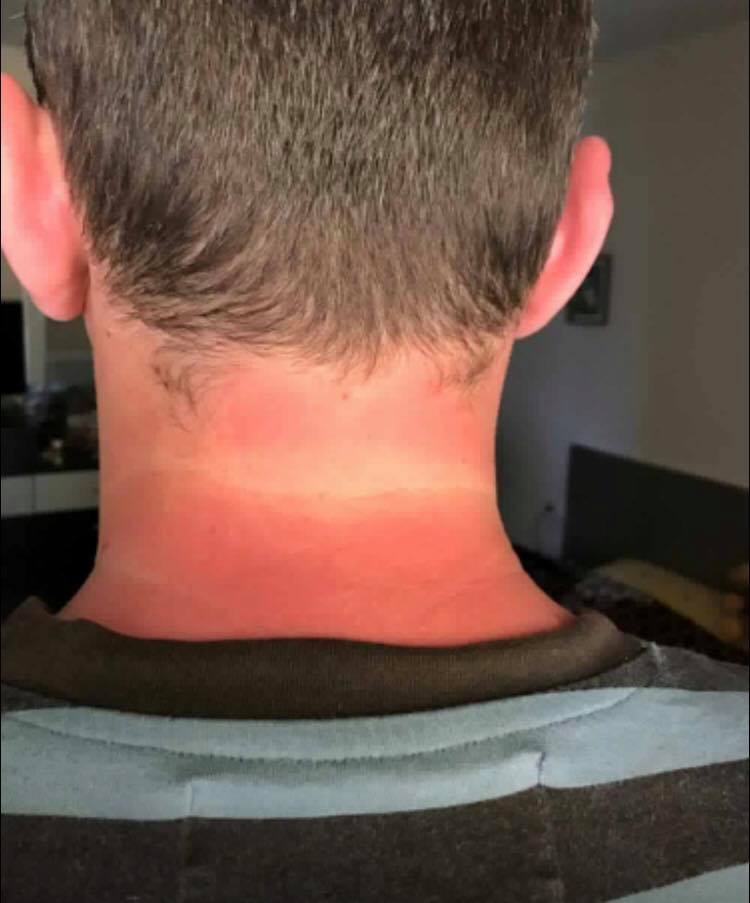 FOTO/Shikoni dëmtimet e helmimit në protestë