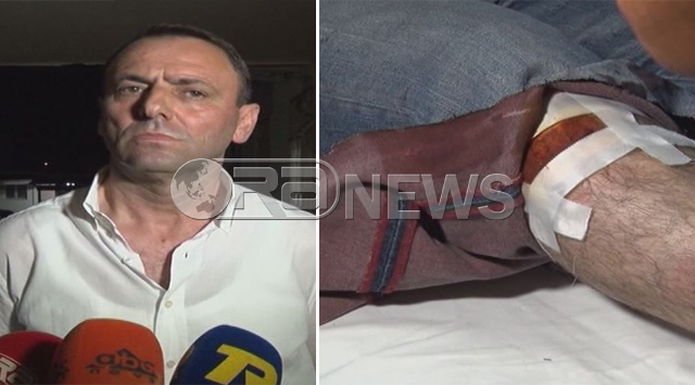 PS rreh përsëdyti LSI-në, dhunohet kryeplaku në Lezhë