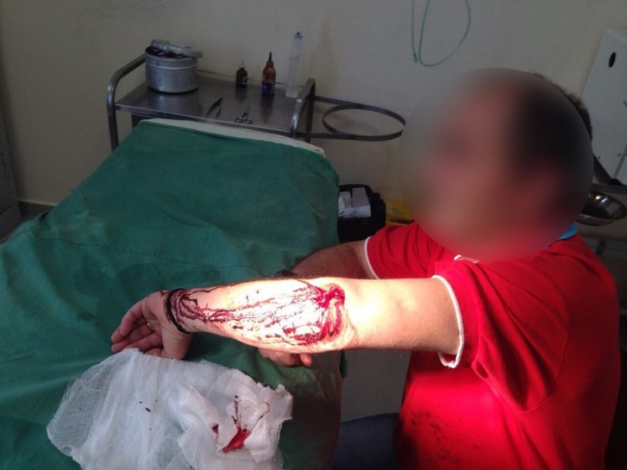 FOTO/ Ksamil, po i kontrollonin biznesin, abonenti dhunon dy punonjës të OSHEE