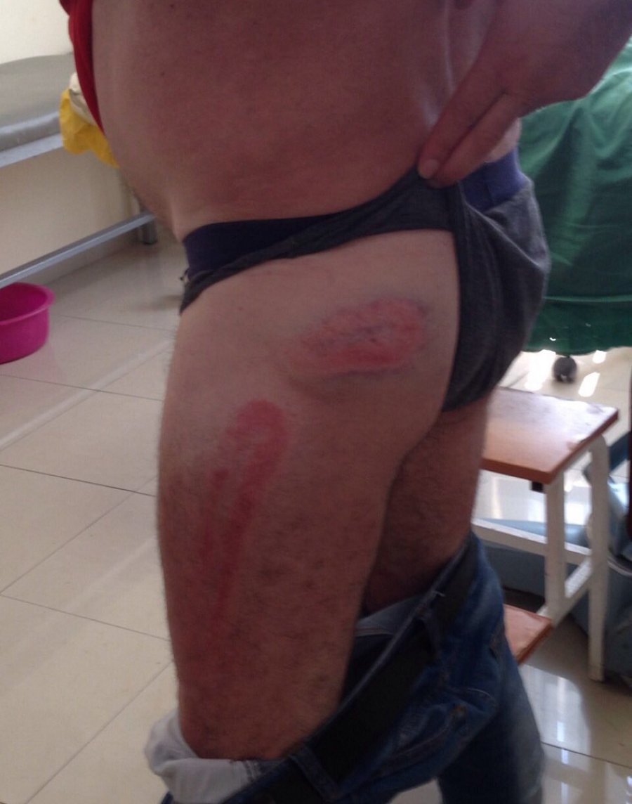 FOTO/ Ksamil, po i kontrollonin biznesin, abonenti dhunon dy punonjës të OSHEE