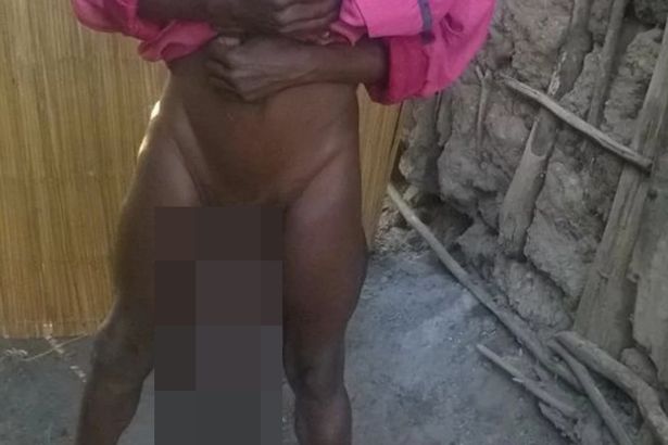 FOTO/ I riu që nuk bën dot seks, madhësia e penisit të tij do t’ju shokojë