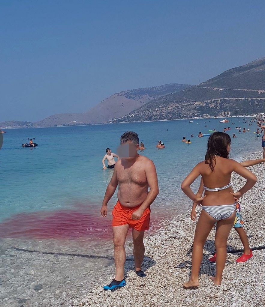 FOTO GALERI/ Borsh, deti skuqet nga gjaku, peshkatari tmerron pushuesit