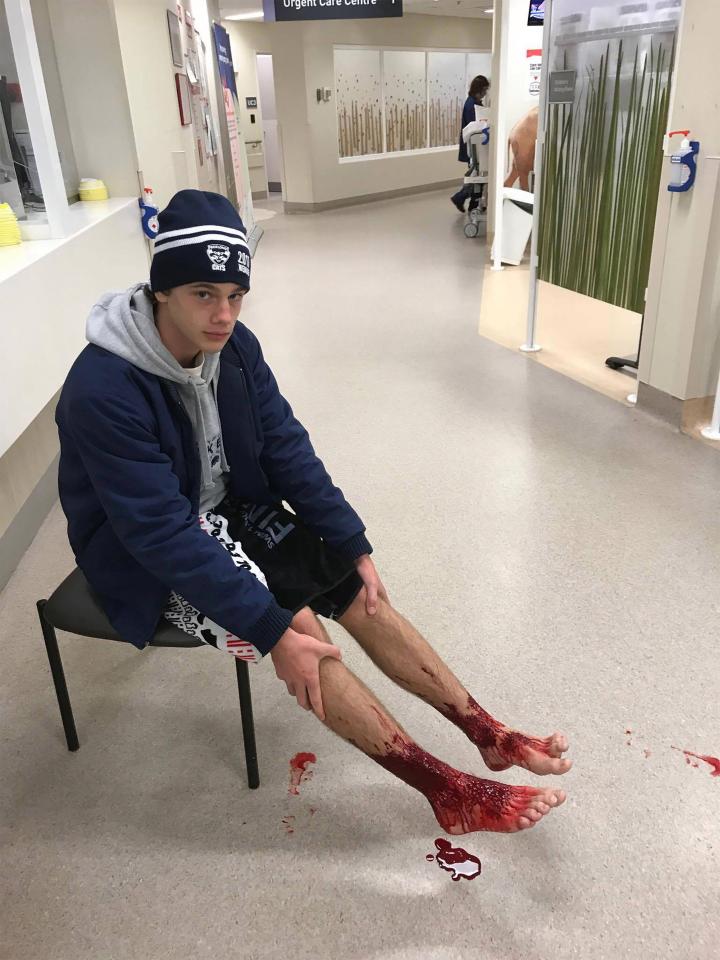 VIDEO/ Adoleshenti futet të lahet, shikoni si e sulmojnë këto krijesa