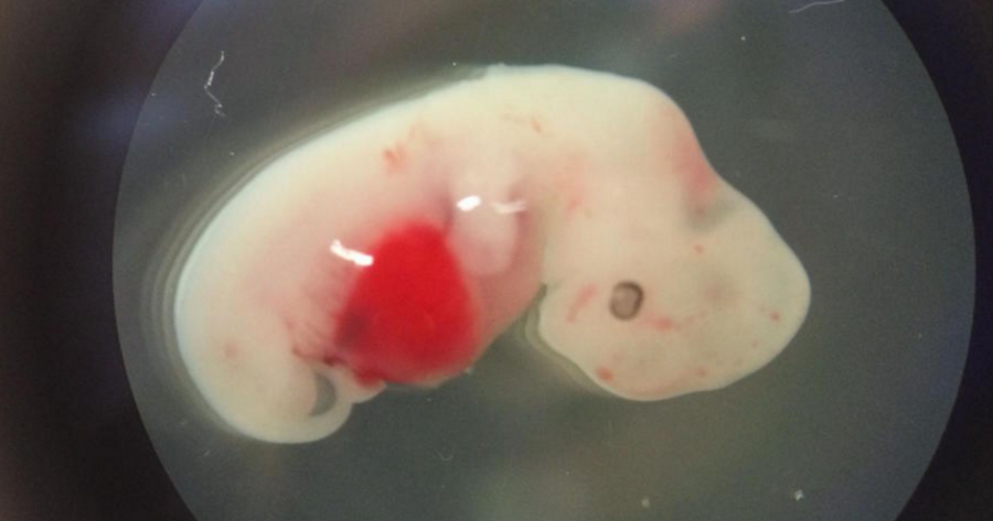 Një shpresë e re për krizën e transplantit të organeve, shkencëtarët krijojnë hibridin njeri-derr