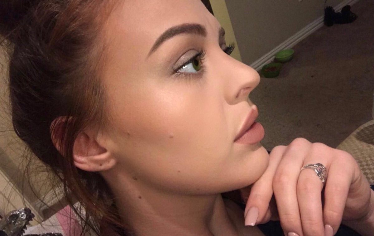 FOTO/ Tronditëse, shtrydhi një puçërr por ajo që i ndodhi ishte e tmerrshme