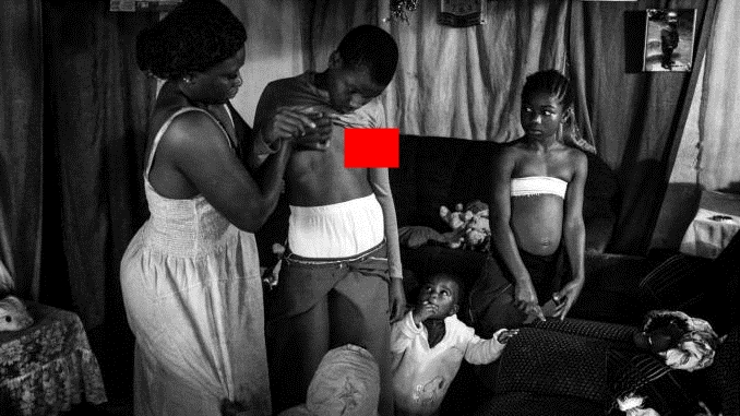 Tradita tronditëse, nënat i detyrojnë vajzat të hekurosin gjoksin