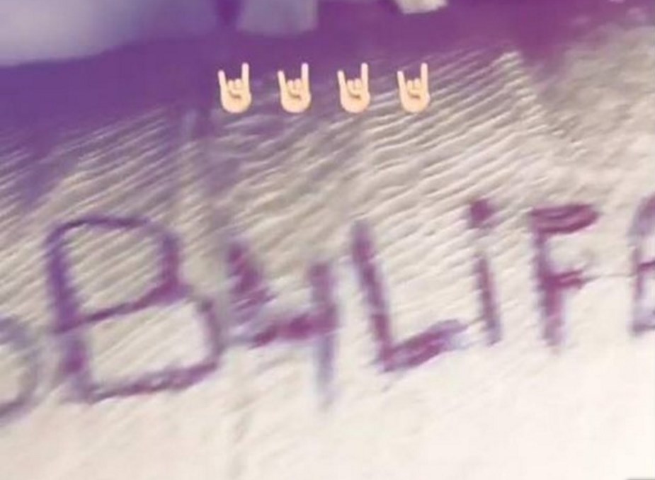 FOTO/ Stresi vërteton aksidentin, poston foto me allci në instagram