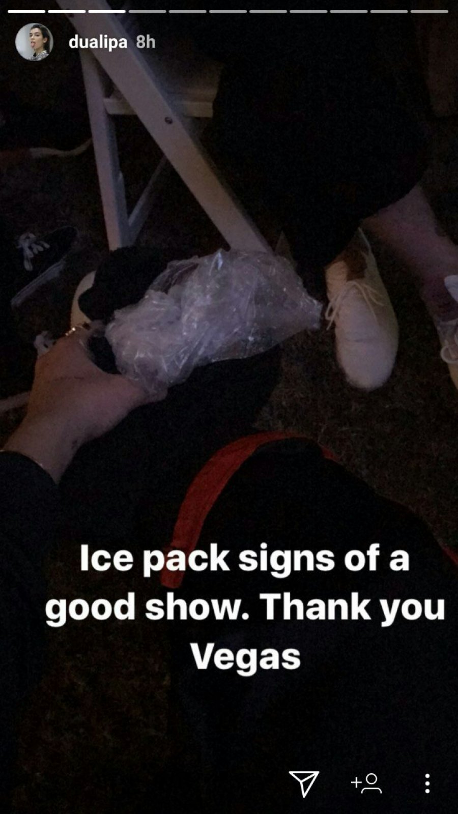 FOTO/ Dua Lipa përfundon e lënduar pas koncertit në Las Vegas