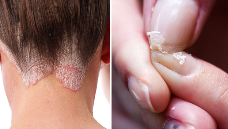 Shenjat që paralajmërojnë se me trupin tuaj po ndodh diçka