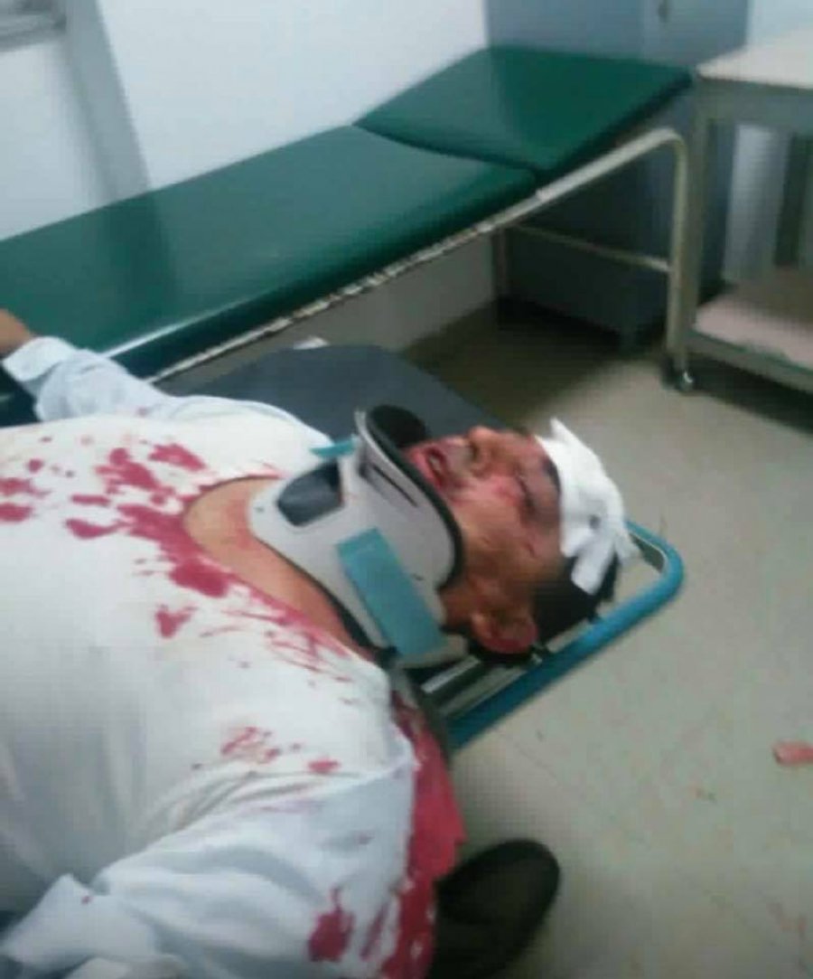 FOTO/ Pamje të tmerrshme, masakrohet gazetari në Kavajë