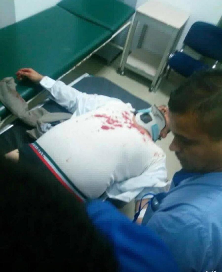 FOTO/ Pamje të tmerrshme, masakrohet gazetari në Kavajë