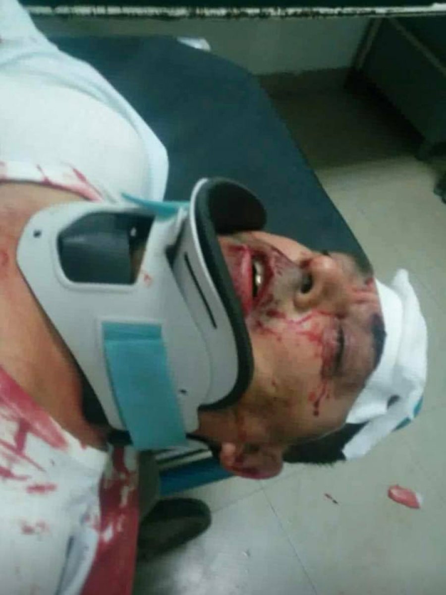 FOTO/ Pamje të tmerrshme, masakrohet gazetari në Kavajë