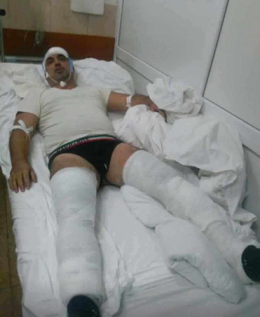 FOTO/ Pamje të tmerrshme, masakrohet gazetari në Kavajë