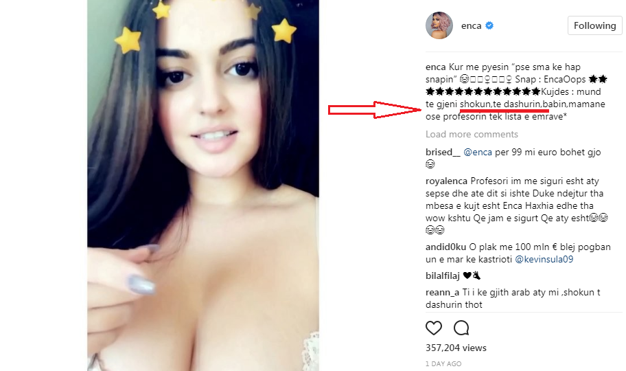 VIDEO/ Oops! Përgjigjia që Enca u dha fansave, vuri në siklet të gjitha femrat