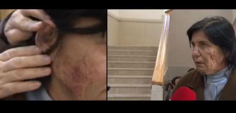 DETAJE/ Grabitja në Shkallnur, autorët qiraxhinj në banesën e çiftit Elezi