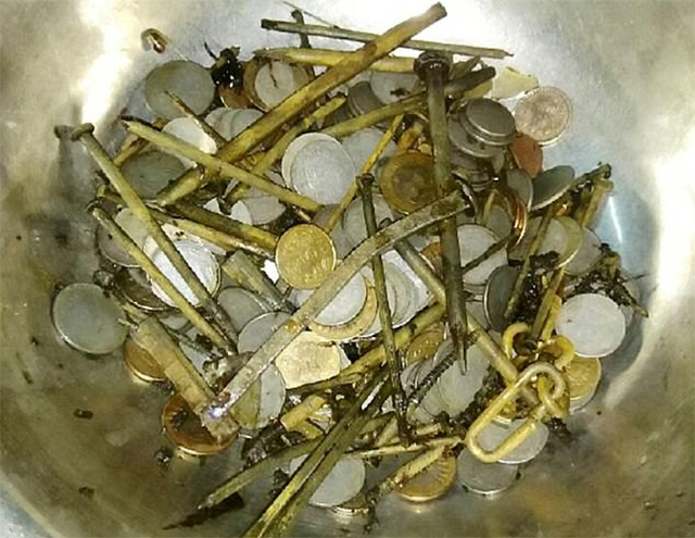 FOTO GALERI/ E rrallë, kirurgët i gjejnë pacientit monedha dhe gozhda “të fshehura” në stomak