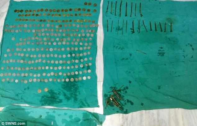 FOTO GALERI/ E rrallë, kirurgët i gjejnë pacientit monedha dhe gozhda “të fshehura” në stomak