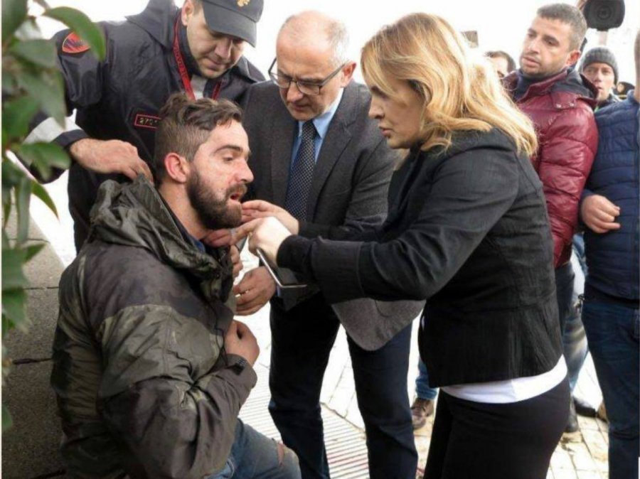 FOTO LAJM/ “Dhuna e kryekriminelit të qeverisë, gjakos njerëz të thjeshtë”