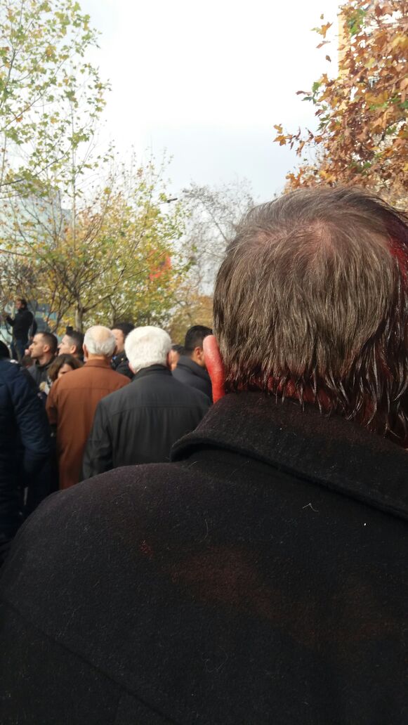 FOTO/ Dhunë dhe kaos para Parlamentit, pamje nga njerëzit e gjakosur