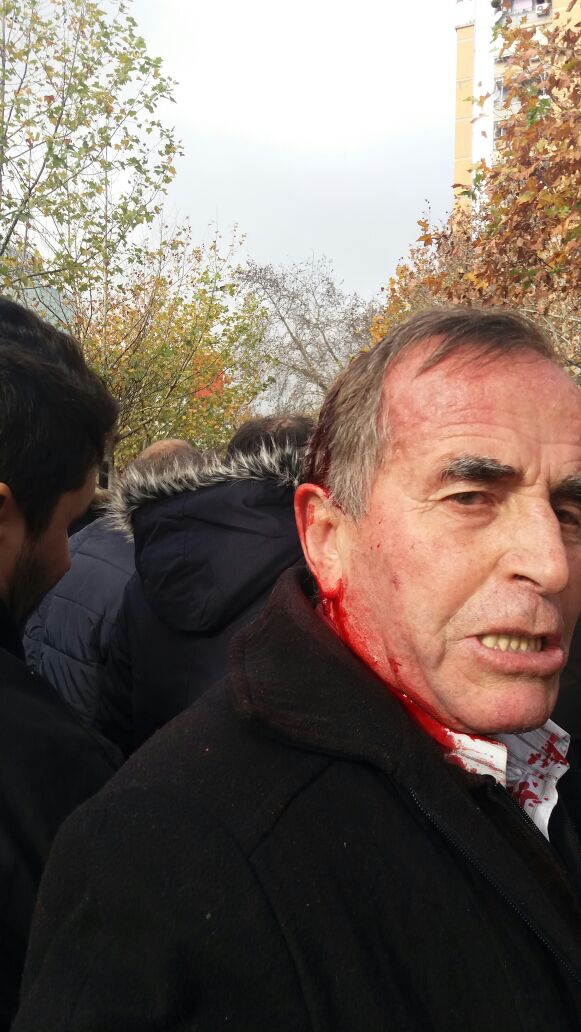 FOTO/ Dhunë dhe kaos para Parlamentit, pamje nga njerëzit e gjakosur