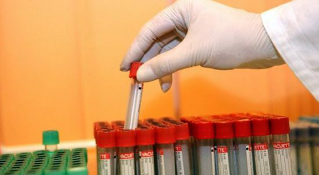 VITI 2017/ Të prekur nga HIV/AIDS, 81 persona, mes tyre 1 fëmijë