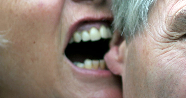 EMRAT/ Sarandë, shoferi i kafshon dhe i këput një copë veshi, pasagjerit nga Berati