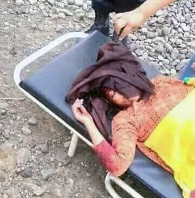 FOTO GALERI/ “Selife” e çmendur, treni godet dhe “ngre në flutrim” një 16-vjeçare