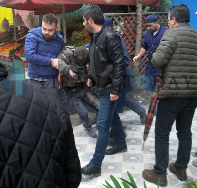 DYSHIME & FOTO/ shpërthimi në Tiranë, i plagosuri montonte mina me celular?!