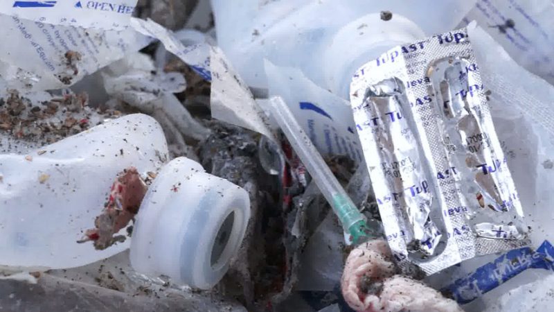 SKANDAL & HETIMI/ Mbetjet spitalore nuk asgjësohen