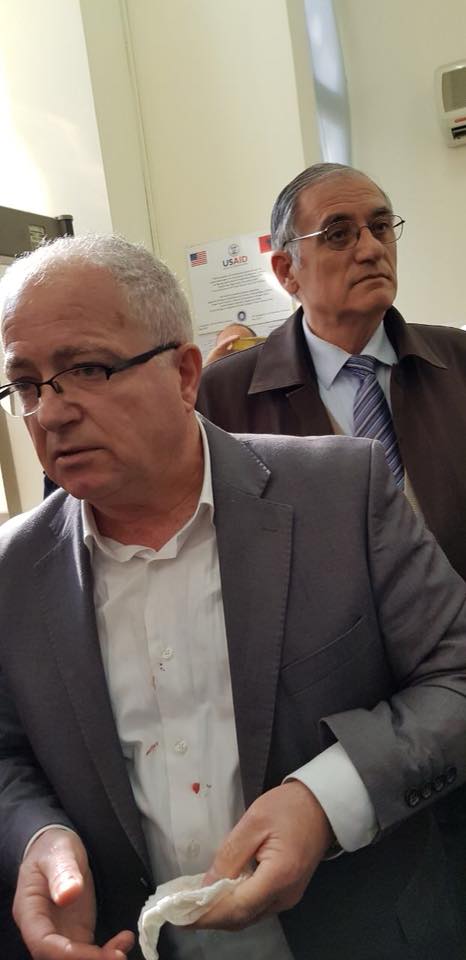 FOTO LAJM/ Policia gjakos Kryetarin e Grupit Parlamentar të PD