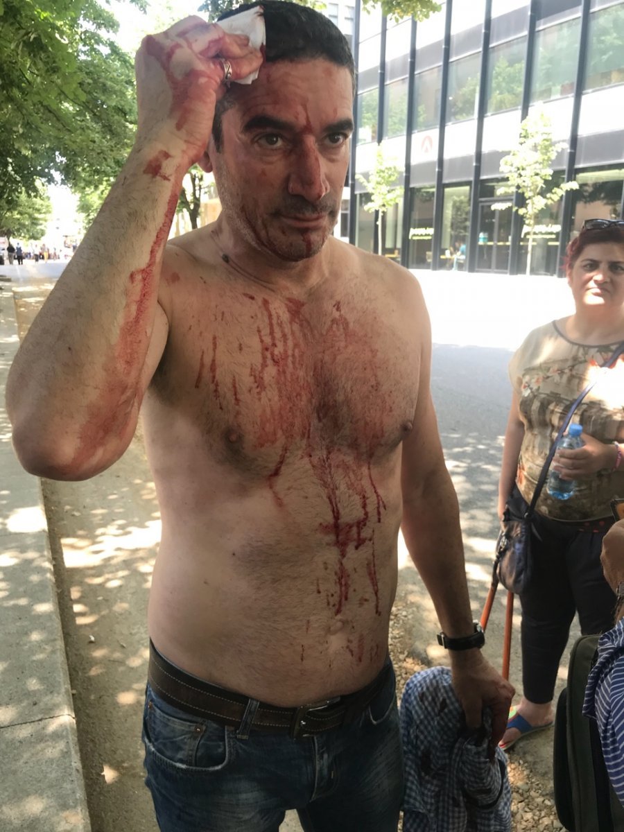 EMRI & FOTO GALERI/ Policia gjakos kryeredaktorin e Rilindjes Demokratike