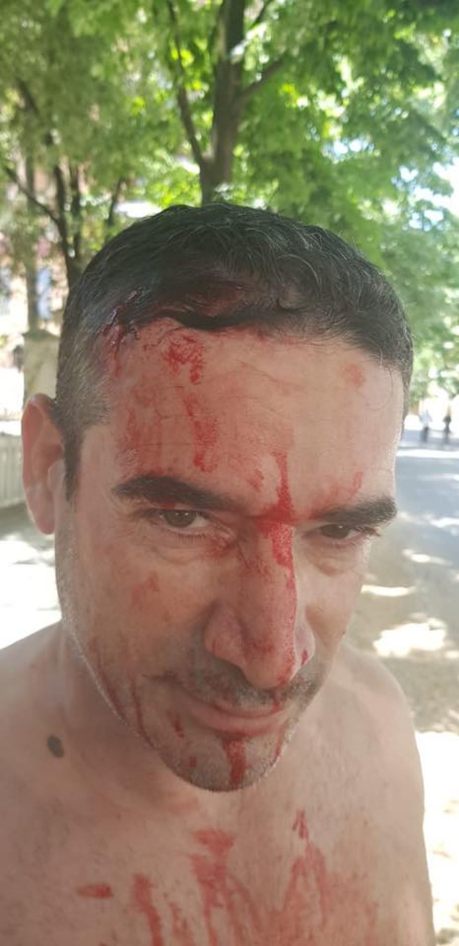 EMRI & FOTO GALERI/ Policia gjakos kryeredaktorin e Rilindjes Demokratike