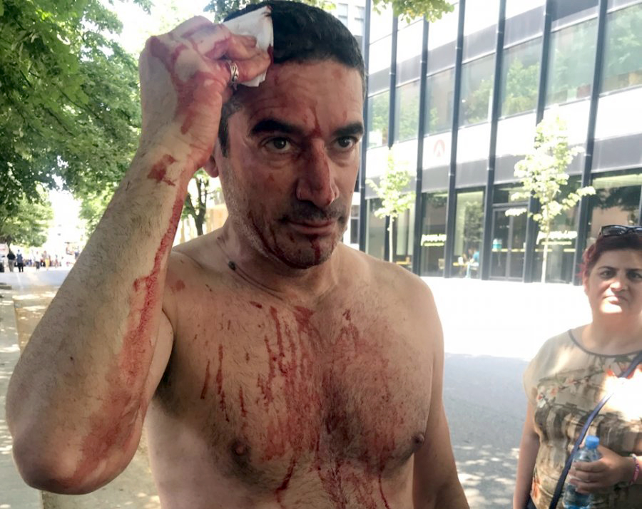 EMRI & FOTO GALERI/ Policia gjakos kryeredaktorin e Rilindjes Demokratike