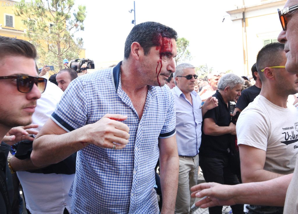 VIDEO/ Ja momenti kur kryeredaktori i RD, Bledi Kasmi u qëllua në kokë nga Policia