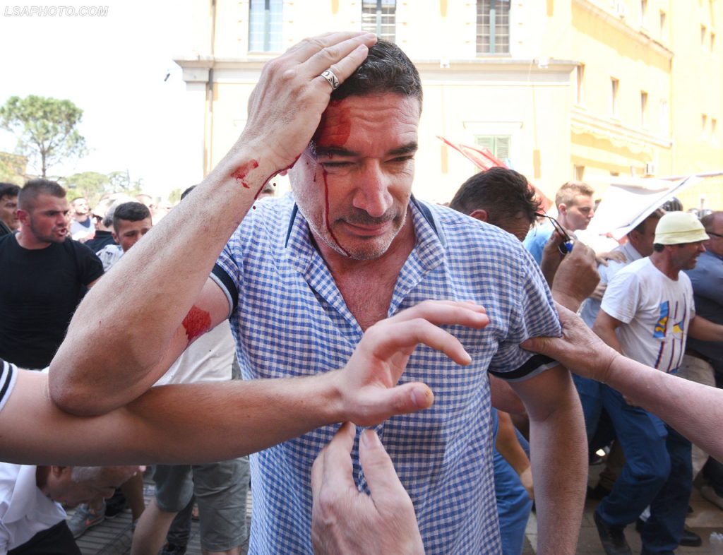 VIDEO/ Ja momenti kur kryeredaktori i RD, Bledi Kasmi u qëllua në kokë nga Policia