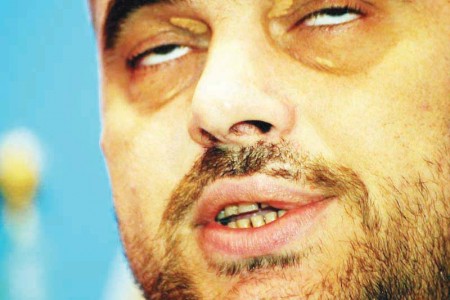 FOTO & DENONCIM/Rama në overdozë,e nxjerrin prej krahu nga avioni