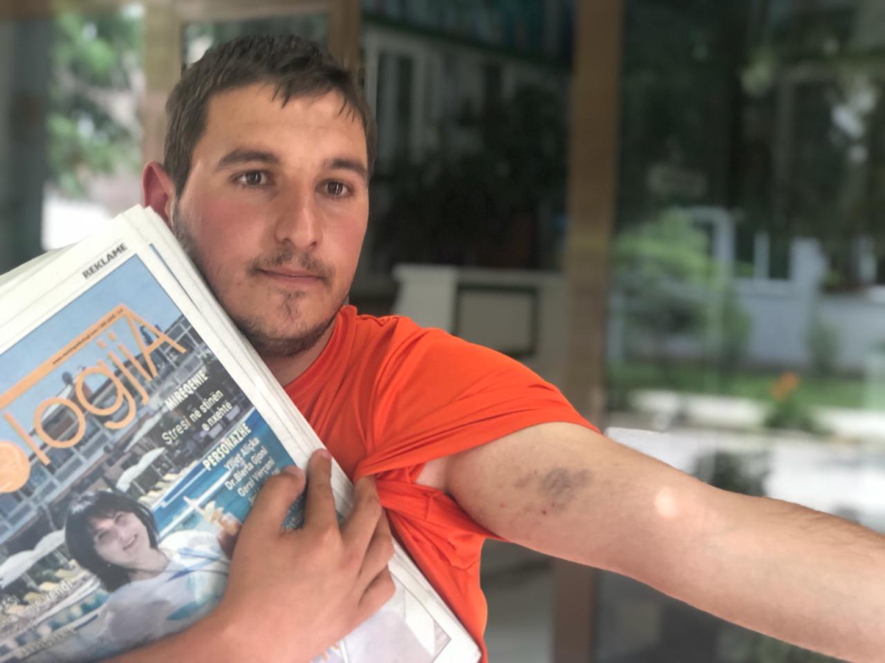 EMRI & FOTO GALERI/ Korçë, pas vdekjes së Eneas, tjetër rrahje në Komisariatin e Policisë