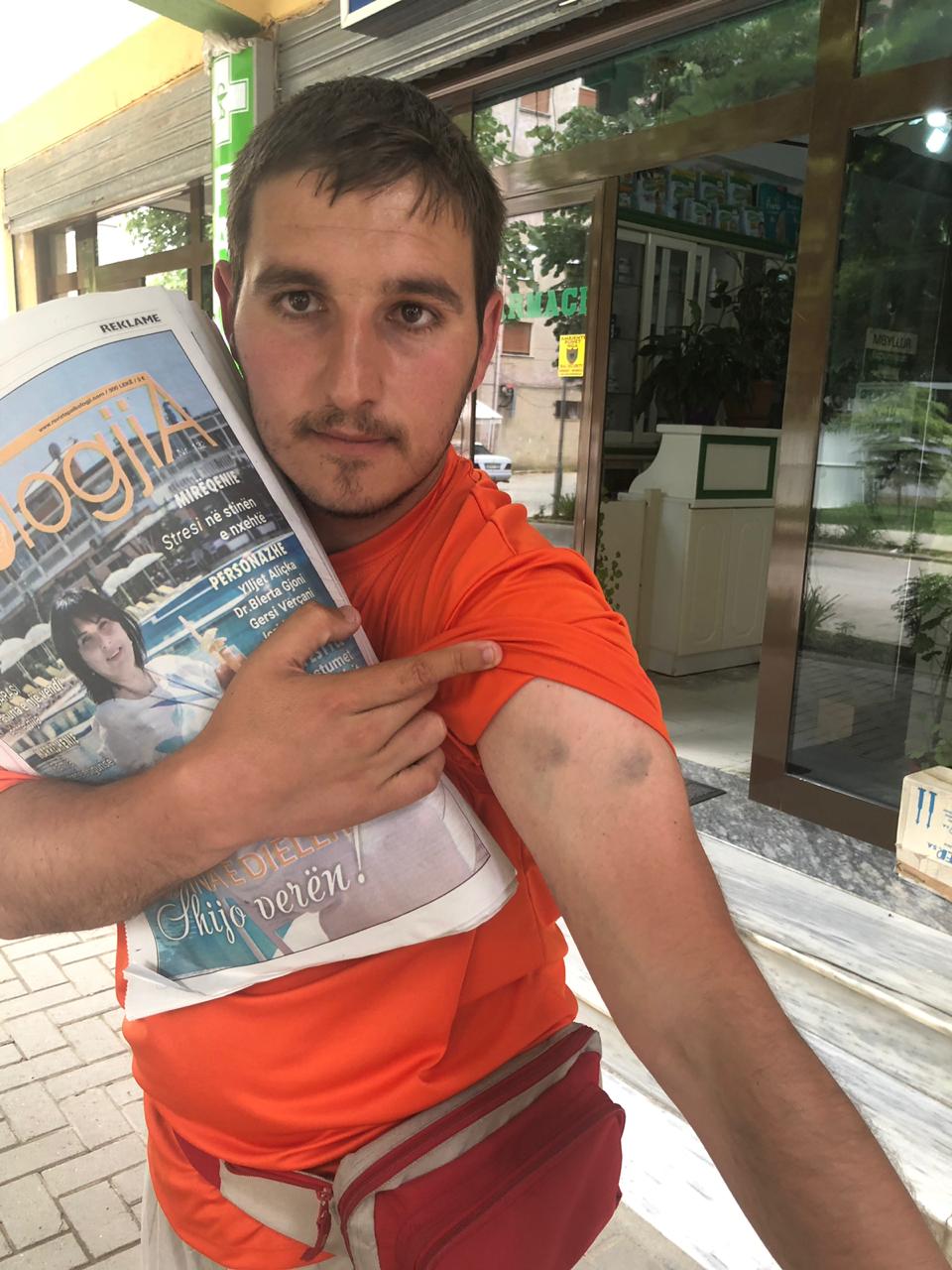 EMRI & FOTO GALERI/ Korçë, pas vdekjes së Eneas, tjetër rrahje në Komisariatin e Policisë