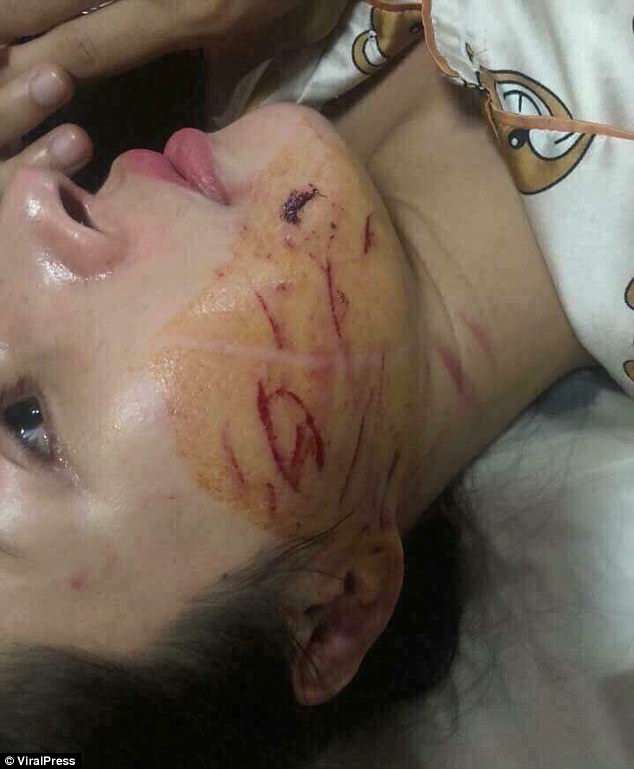 FOTO GALERI/ Zhvesh të dashurën e burrit në mes të rrugës, e lyen me salcë peshku e spec djegës