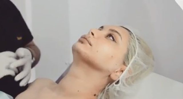 Çiljeta Xhilaga pendohet për operacionin plastik