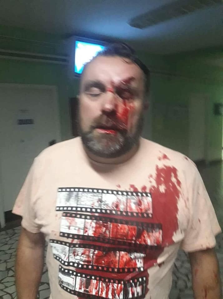 Rrihet brutalisht gazetari, po hetonte vrasjen e Ivanoviçit (Foto)