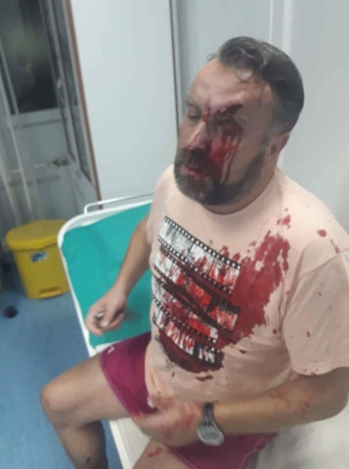 Rrihet brutalisht gazetari, po hetonte vrasjen e Ivanoviçit (Foto)