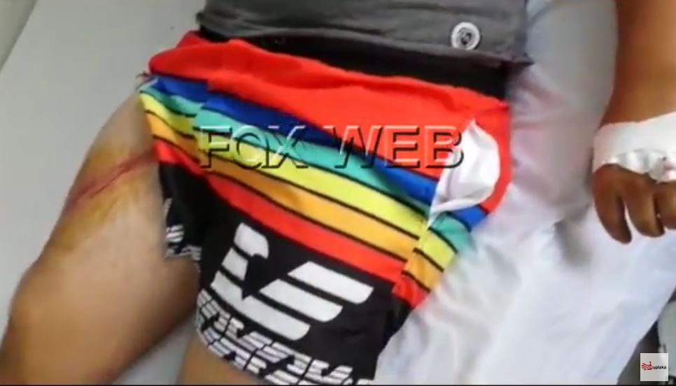 VIDEO/Humbi dy kushërinjtë e tij, i riu me plagë të rënda tregon si ndodhi aksidenti në Roskovec