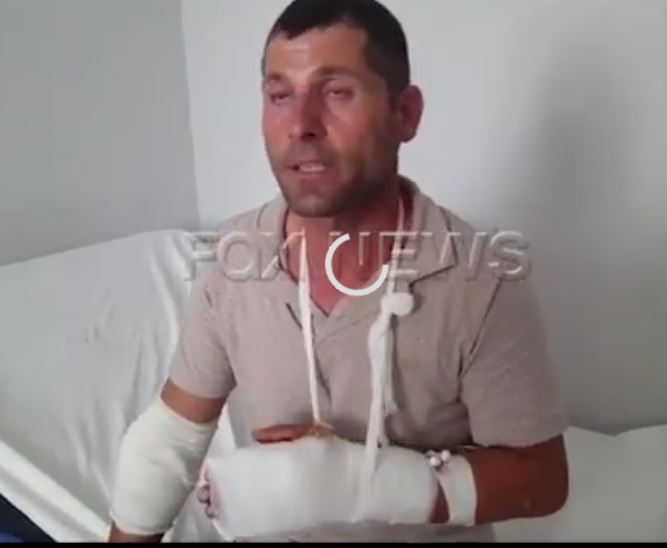 VIDEO/Konflikti me sëpatë në Fier, njëri nga të plagosurit tregon si nisi sherri