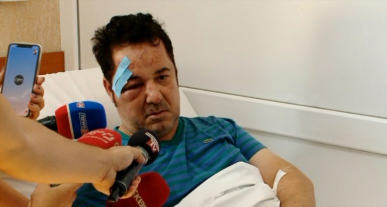 E dhunuan pranë banesës, flet biznesmeni nga Tirana: Shteti të merret me këto banda