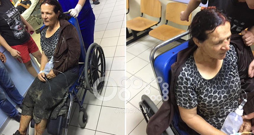 Gruaja e dhunuar në Durrës thirrje Arta Markut: Mos na çoni në masakra…