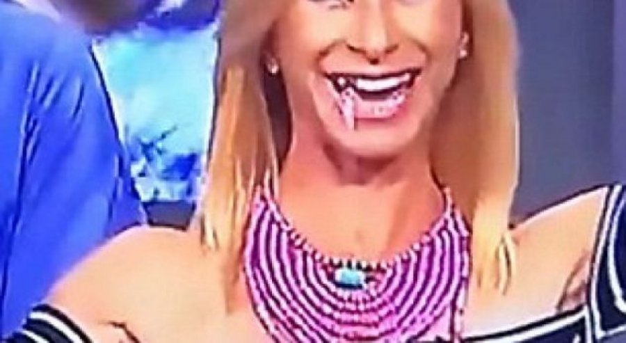 VIDEO/ Kulmi i sikletit, prezantueses së njohur i bie dhëmbi gjatë emisionit
